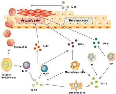 Advances in pathogenesis and nanoparticles (NPs)-mediated treatment of psoriasis